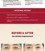 SEOUL 1988 Eye Cream : Retinal Liposome 4% + Fermented Bean