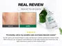 PDRN Skin Booster Set