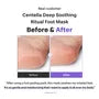 Centella Deep Soothing Ritual Foot Mask 1 pair 5pcs Bundle Set