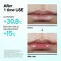 PDRN Lip Serum