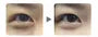 Dark Circle Removal Golden Eye Mask 2pcs Bundle Set