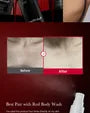 Red Acne Body Peeling Shot