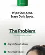 A-Control 10% Azelaic Acid Serum