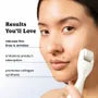 Derma Roller Micro Needle Kit