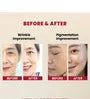 SEOUL 1988 Serum : Retinal Liposome 2% + Black Ginseng 2pcs Bundle Set