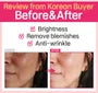 Small Molecular Collagen C 5pcs Bundle Set