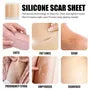 Silicone Scar Sheet Tape