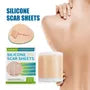 Silicone Scar Sheet Tape