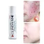 M Acne Water