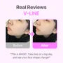 V-Line Chews Bundle Set - 2 Types