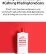 Anti Blemish Body Lotion Back & Chest