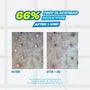 Blackhead Melting Softener Special Set